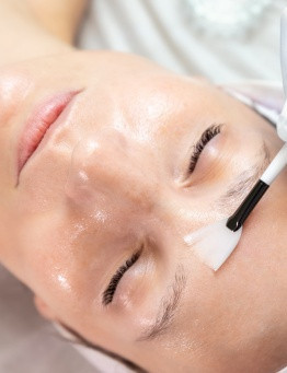 Peeling chemiczny