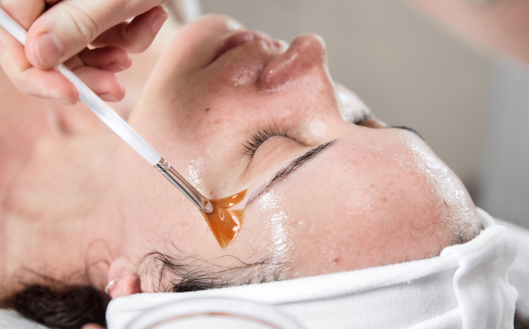 kosmetolog nakłada kwasową mieszankę na twarz